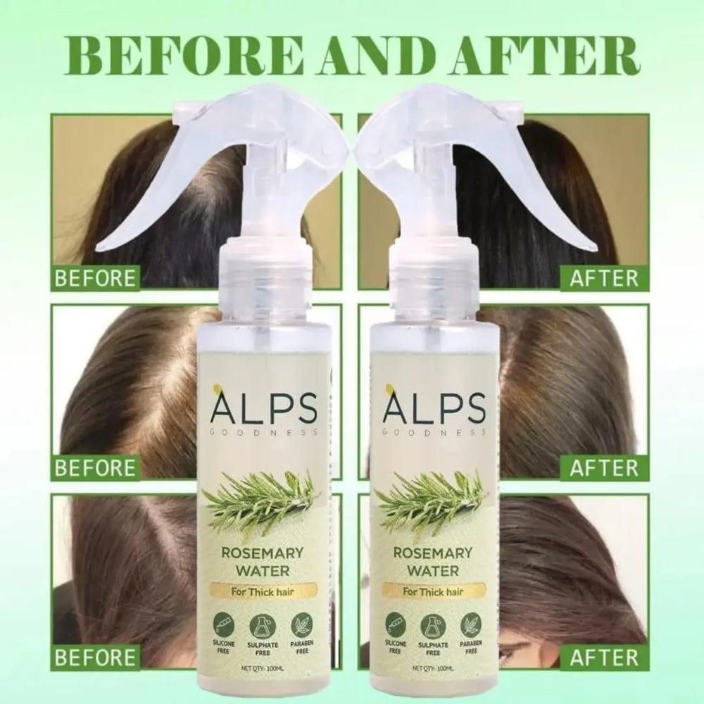 Rosemary Hair Spray for Hair Regrowth (Buy 1 Get 2 Free | 100ml Each)