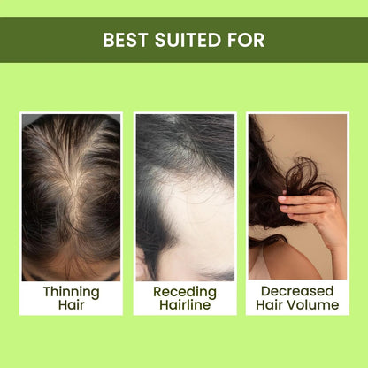 Rosemary Hair Spray for Hair Regrowth (Buy 1 Get 2 Free | 100ml Each)